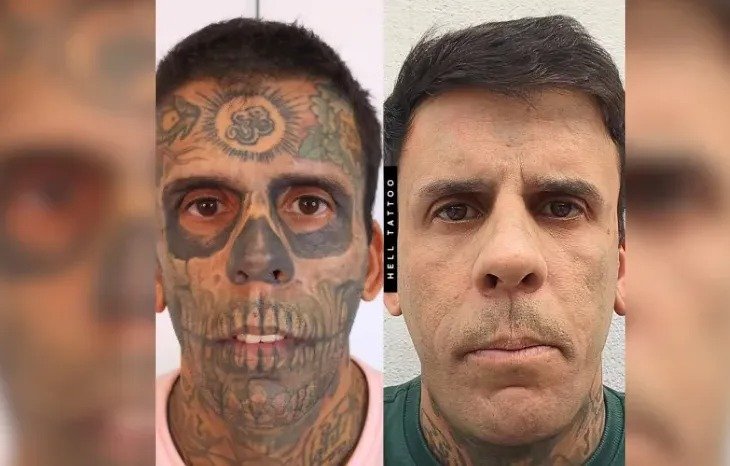 Gaúcho Mais Tatuado do Brasil Pede Ajuda Contra Tumor na Bexiga